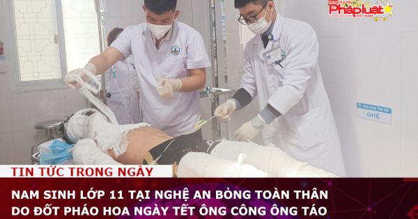 Nam sinh lớp 11 tại Nghệ An bỏng toàn thân do đốt pháo hoa ngày Tết ông Công ông Táo