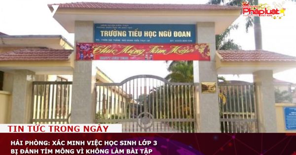 Hải Phòng: Xác minh việc học sinh lớp 3 bị đánh tím mông vì không làm bài tập