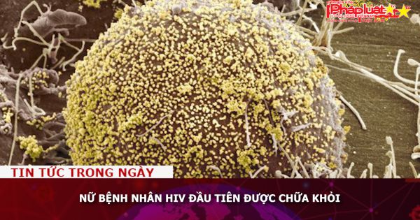 Nữ bệnh nhân HIV đầu tiên được chữa khỏi