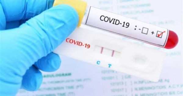 Từ ngày 21/2, giá dịch vụ xét nghiệm COVID-19 nhanh tối đa 78.000 đồng/xét nghiệm, giảm 30% so với trước