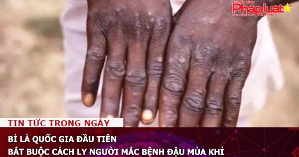 Bỉ là quốc gia đầu tiên bắt buộc cách ly người mắc bệnh đậu mùa khỉ