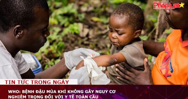 WHO: Bệnh đậu mùa khỉ không gây nguy cơ nghiêm trọng đối với y tế toàn cầu