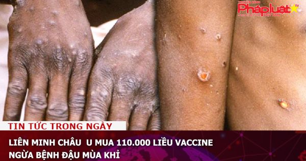Liên minh Châu Âu mua 110.000 liều vaccine ngừa bệnh đậu mùa khỉ