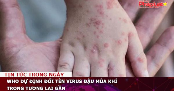 WHO dự định đổi tên virus đậu mùa khỉ trong tương lai gần