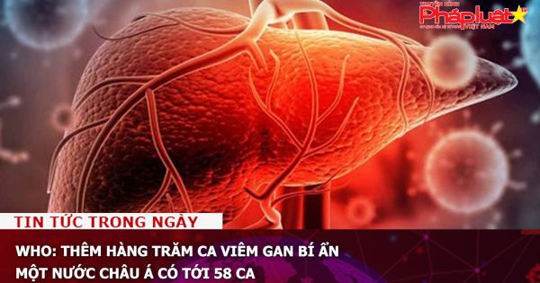 WHO: Thêm hàng trăm ca viêm gan bí ẩn, một nước châu Á có tới 58 ca