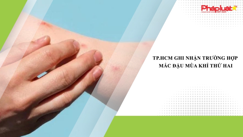 TP.HCM ghi nhận trường hợp mắc đậu mùa khỉ thứ hai