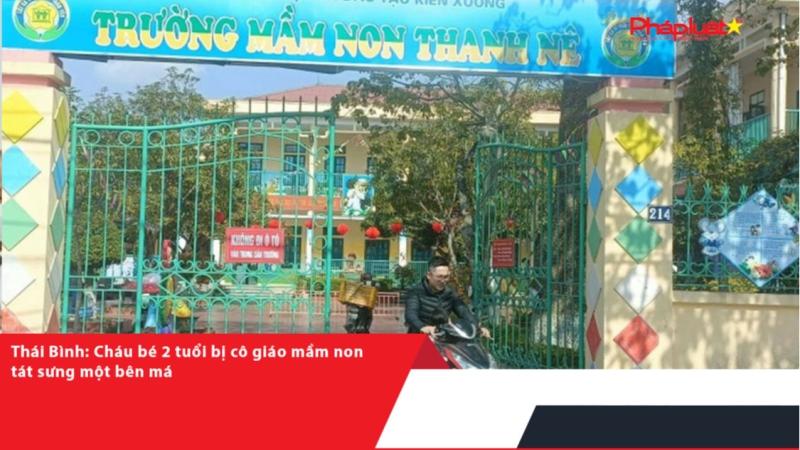 Thái Bình: Cháu bé 2 tuổi bị cô giáo mầm non tát sưng một bên má
