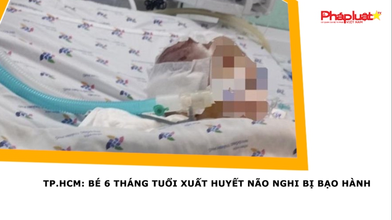 TP.HCM: Bé 6 tháng tuổi xuất huyết não nghi bị bạo hành