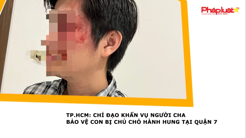 TP.HCM: Chỉ đạo khẩn vụ người cha bảo vệ con bị chủ chó hành hung tại Quận 7