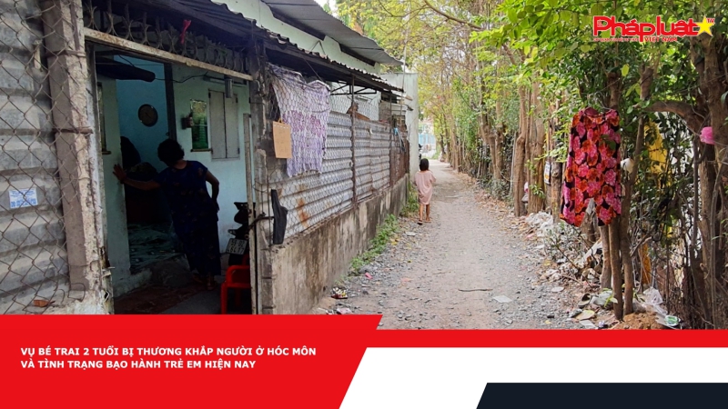 Vụ bé trai 2 tuổi bị thương khắp người ở Hóc Môn và tình trạng bạo hành trẻ em hiện nay