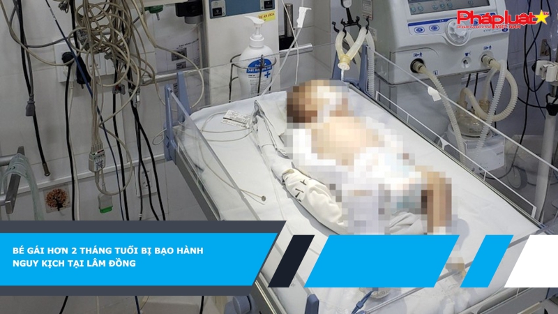 Bé gái hơn 2 tháng tuổi bị bạo hành nguy kịch tại Lâm Đồng