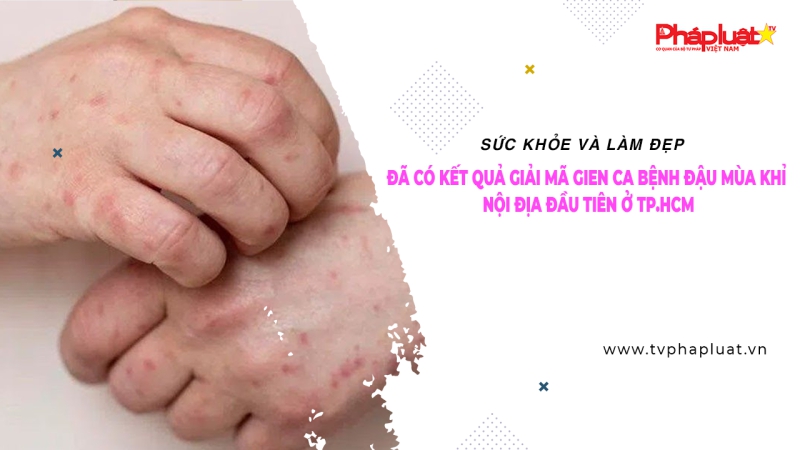 BẢN TIN SỨC KHOẺ VÀ LÀM ĐẸP: Đã có kết quả giải mã gene của trường hợp mắc bệnh đậu mùa khỉ đầu tiên tại TP. HCM