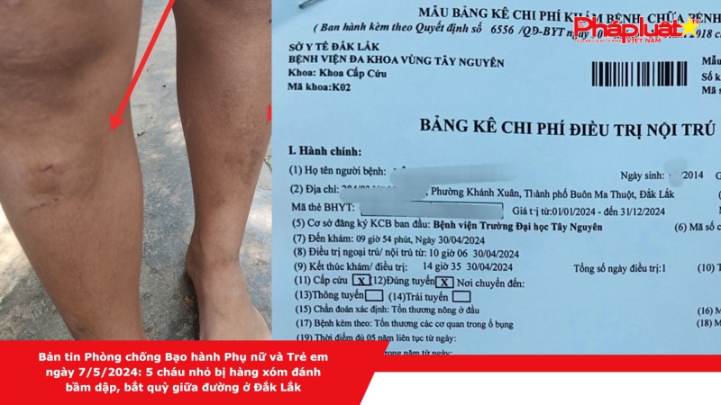 Bản tin Phòng chống Bạo hành Phụ nữ và Trẻ em ngày 7/5/2024: 5 cháu nhỏ bị hàng xóm đánh bầm dập, bắt quỳ giữa đường ở Đắk Lắk